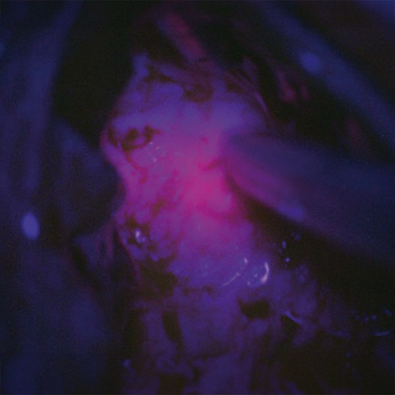 Операционная система для нейрохирургии ZEISS KINEVO 900